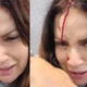 ex-atriz-da-globo-aparece-sangrando-em-video-apos-acidente:-‘fiquem-atentos’
