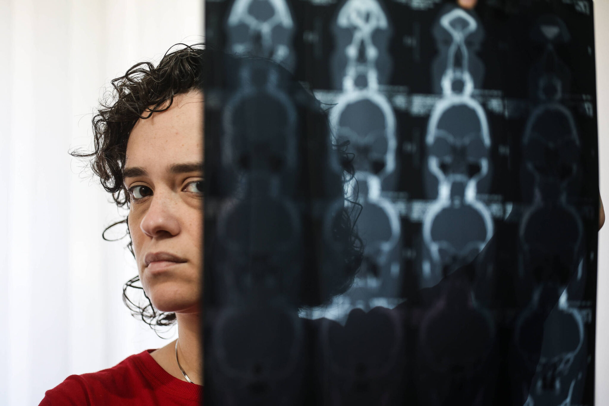 entenda-o-que-e-a-sindrome-da-fadiga-cronica,-doenca-que-causa-cansaco-extremo