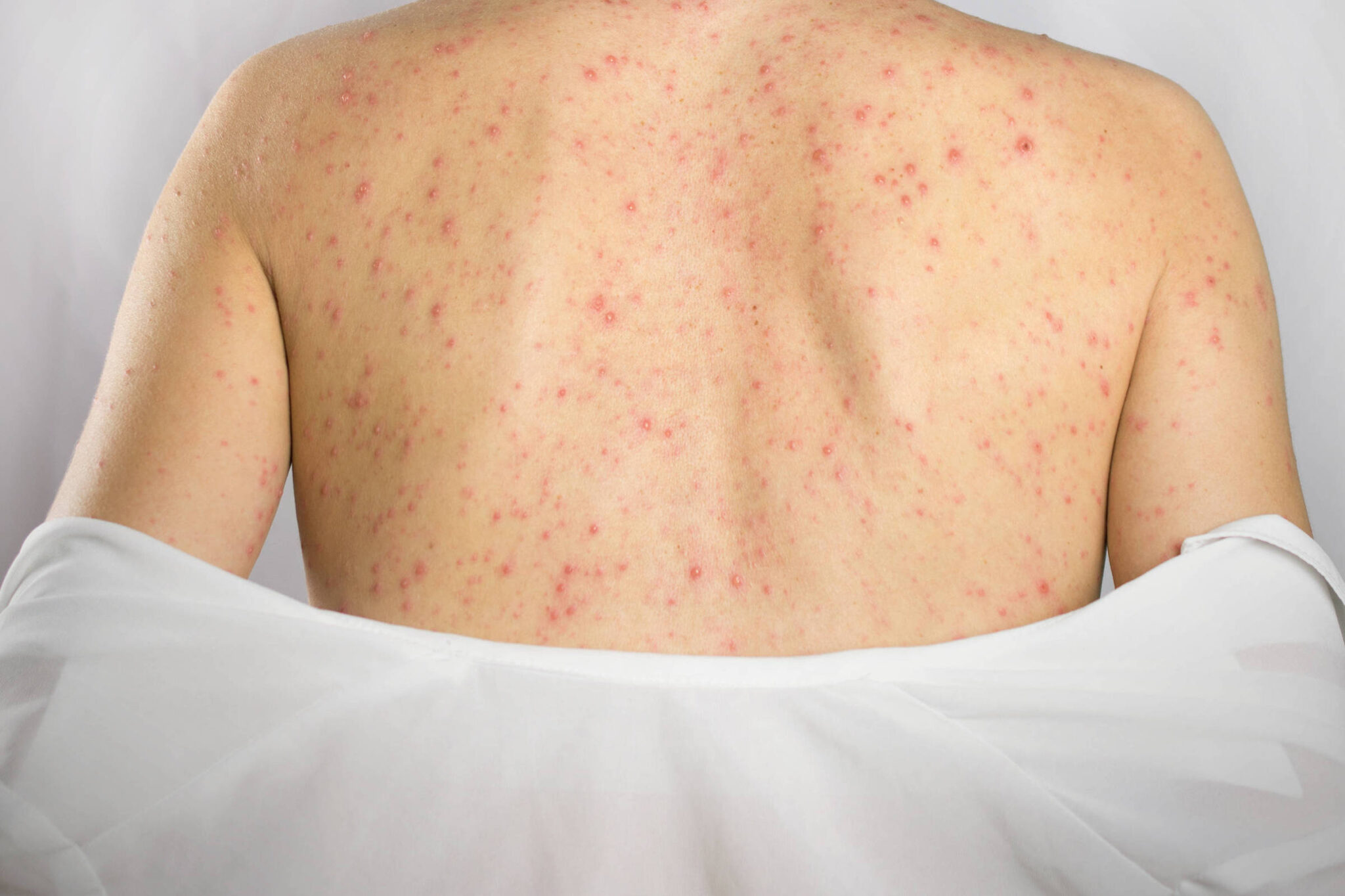 riscos-de-chip-da-beleza-sao-maiores-do-que-possiveis-beneficios,-diz-endocrinologista