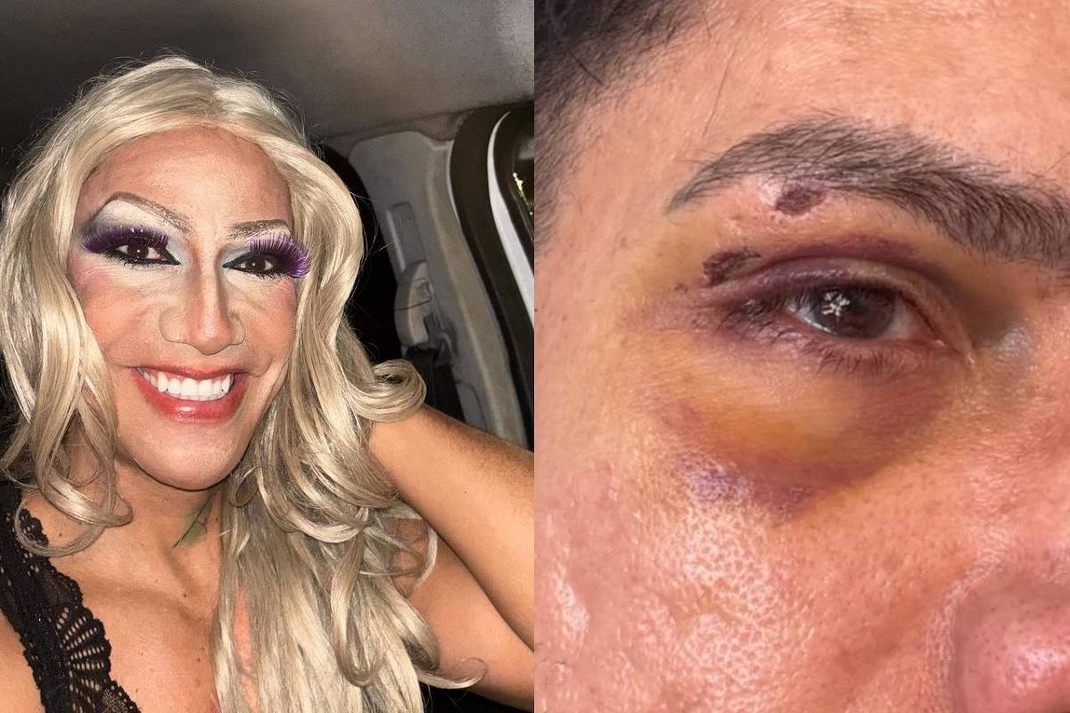 arquiteto-denuncia-agressao-por-homofobia-durante-carnaval-de-olinda