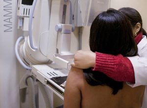 senado-aprova-projetos-que-antecipam-idade-minima-para-mamografia-no-sus