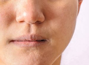 mulheres-com-ciclo-menstrual-irregular-tem-mais-problemas-de-pele