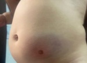 bebe-e-atingida-por-bala-perdida-no-reveillon-em-sp:-‘nao-parava-de-gritar’