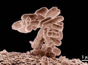 conheca-a-sindrome-da-autocervejaria,-doenca-rara-que-deixa-pessoas-bebadas