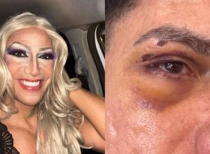 arquiteto-denuncia-agressao-por-homofobia-durante-carnaval-de-olinda